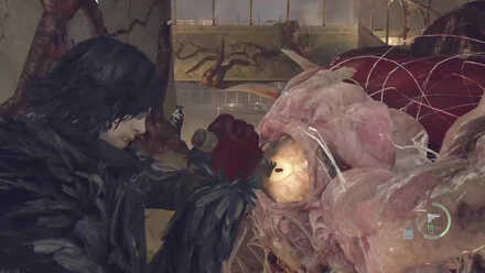 RE4 Remake - Salazar Weak Spot Eye.jpg