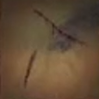 Skull and Bones - Field Sutures