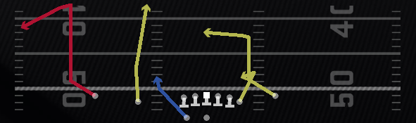 Comeback Z Post Play