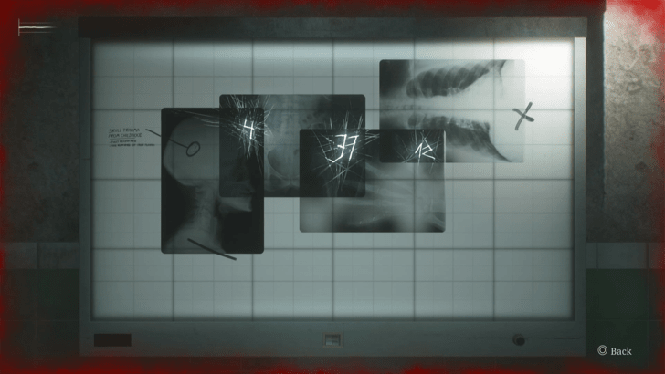 Solve the X-Ray Puzzle