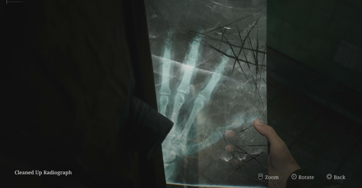 Moldy Radiograph Ues