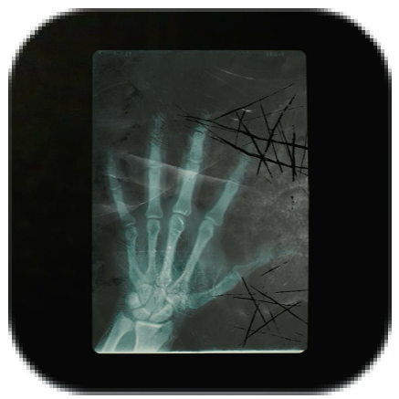 Cleaned Up Radiograph Icon