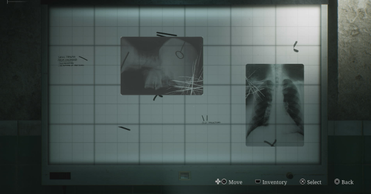 Radiograph of a Pelvis Use