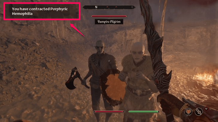 Disease Contracted Notification