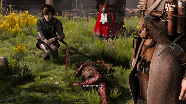 Anna Bursts into Flames