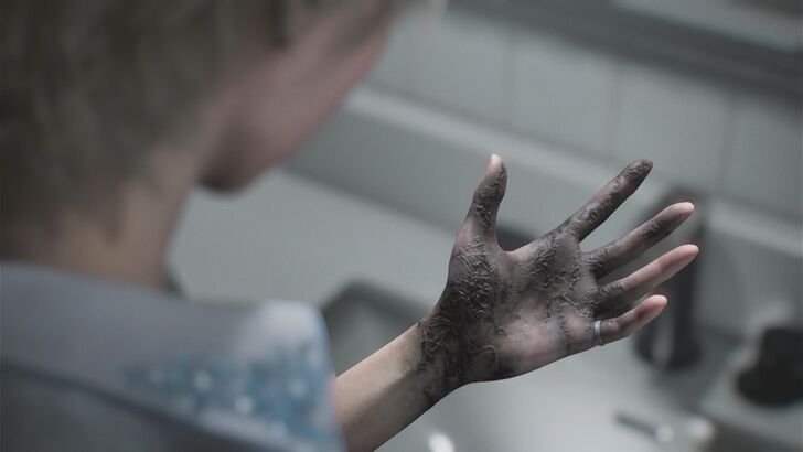 Sherry Birkin Infection