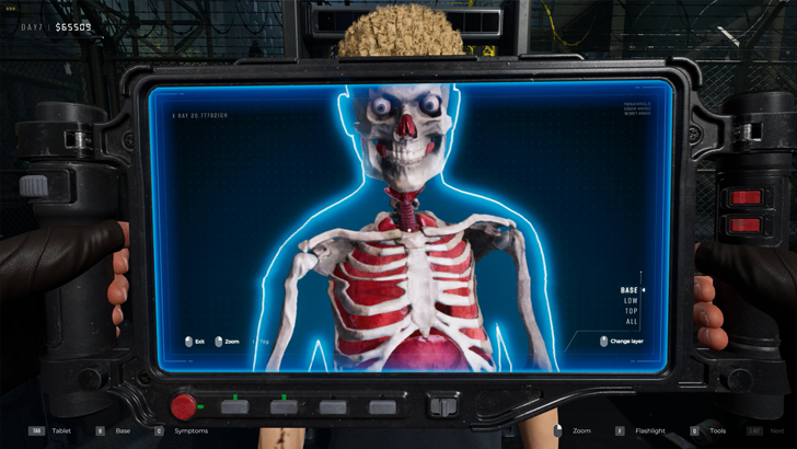 xray human